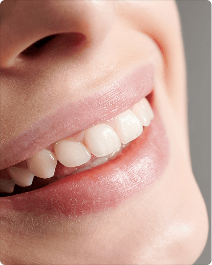 Teeth whitening