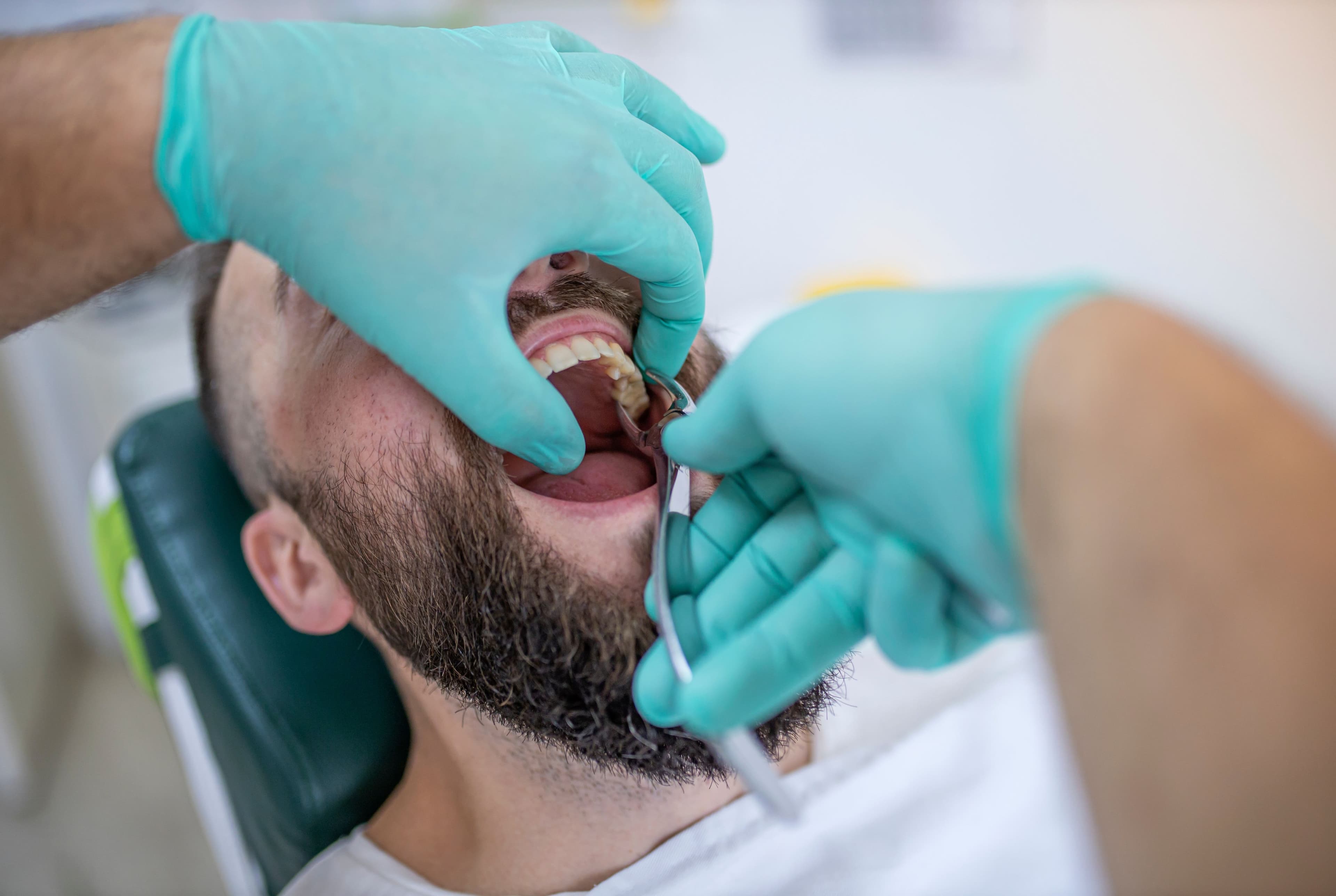 Will the Hospital Pull a Tooth in Canada? All You Need to Know