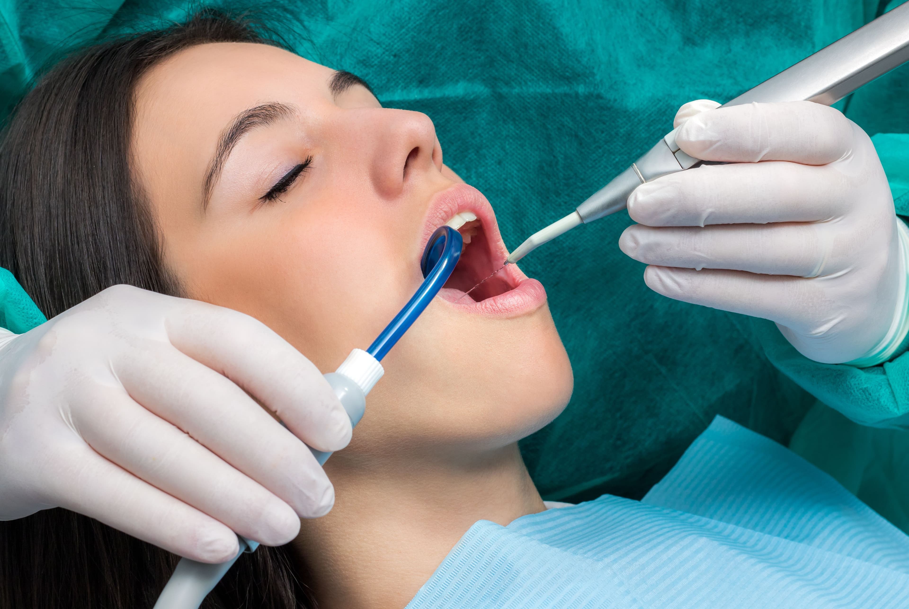 Why Are Dental Cleanings Important (More Than You Think)