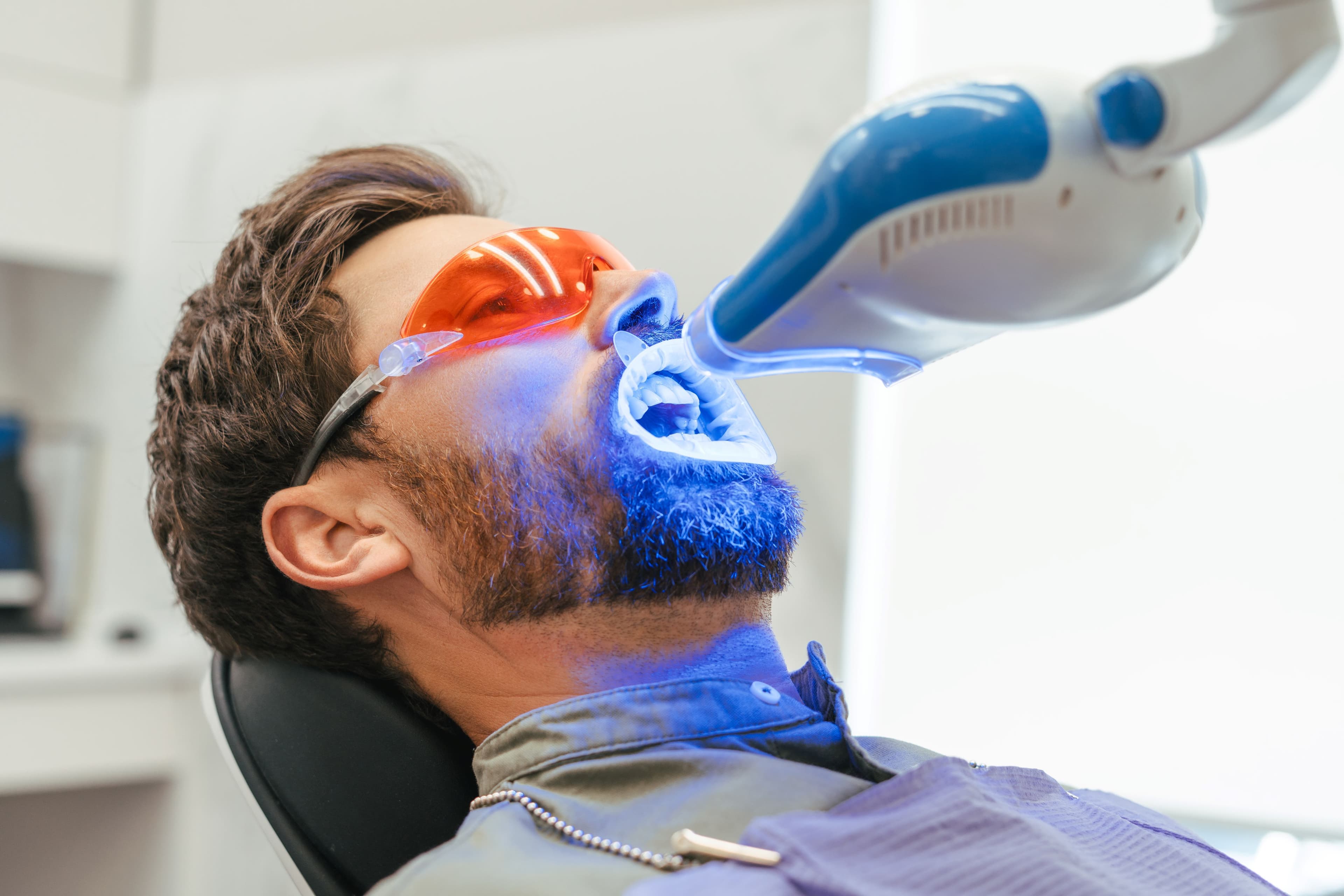 How long does teeth whitening last?
