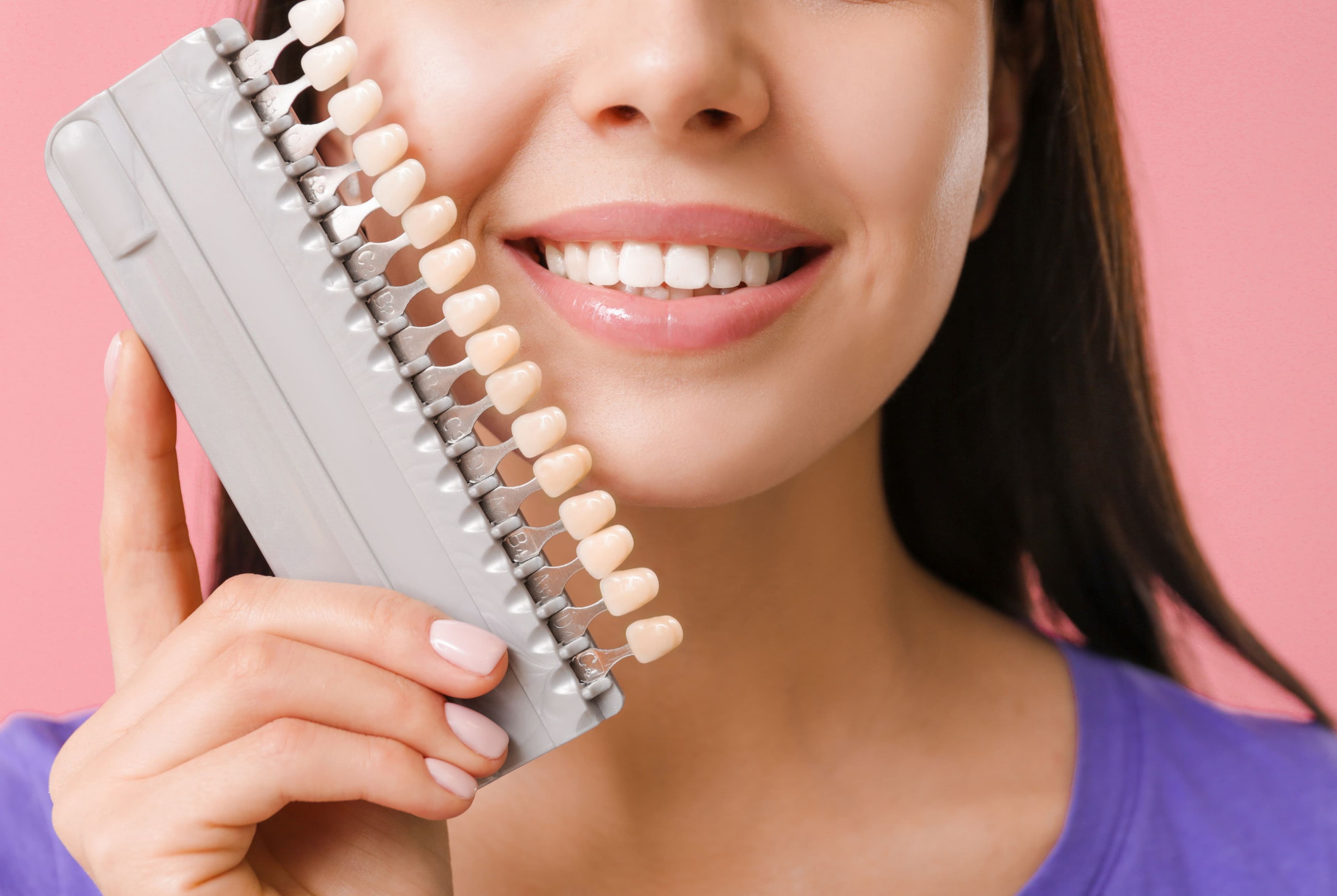 How Much do Veneers Cost in Canada?