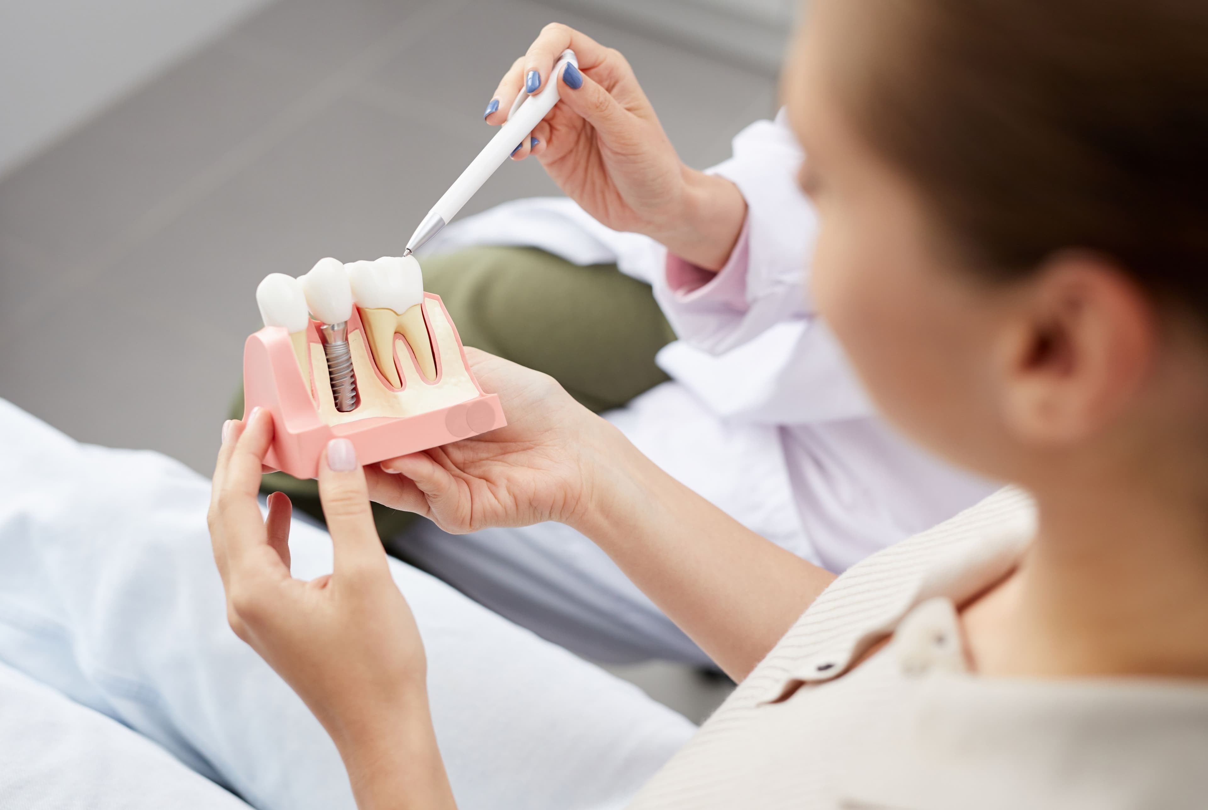 What Are the 3 Types of Dental Implants? A Full Guide